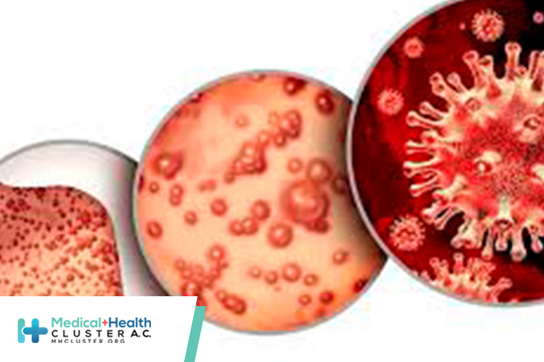 Neonatal Monkeypox Virus Infection